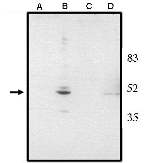 "Western blot analysis using anti-Chx10 (NT)
antibody at 1 µg/ml on rat liver (A), retina tissue lysate (B), mouse liver (C) and retina (D) tissue lysate."